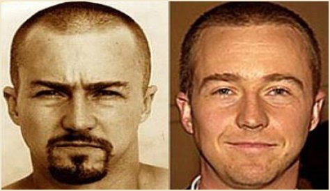 Edward Norton Plastic Surgery Before and After
